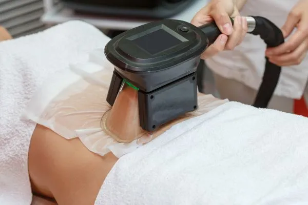 Image of person having fat freezing treatment to help weight gain Willenhall