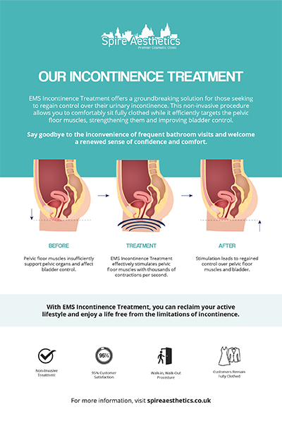 image to show how EMS treatment works for female urinary incontinence Willenhall