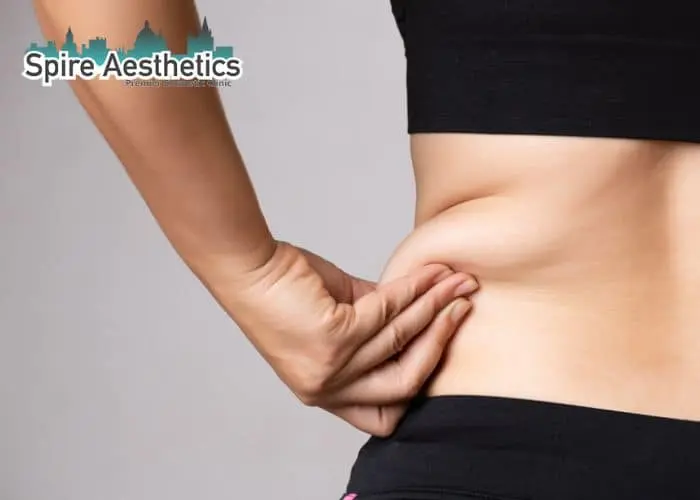 Image of woman pinching fat on their hips Willenhall. Fat Freezing treatment