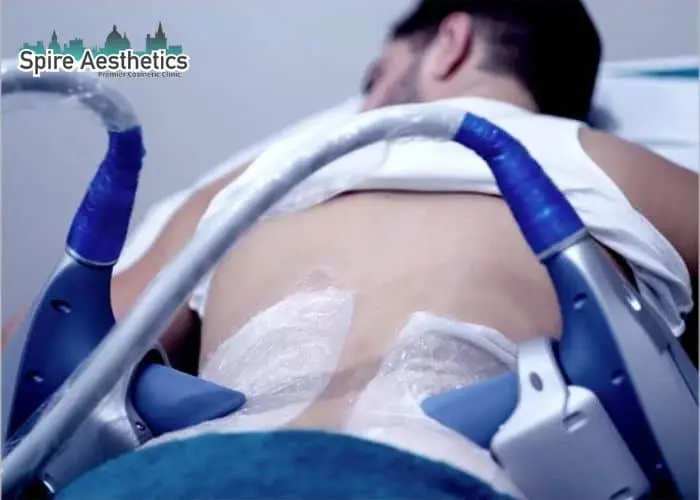 Man having fat freezing treatment done on love handles before a competitions Willenhall to create a sculpted look.