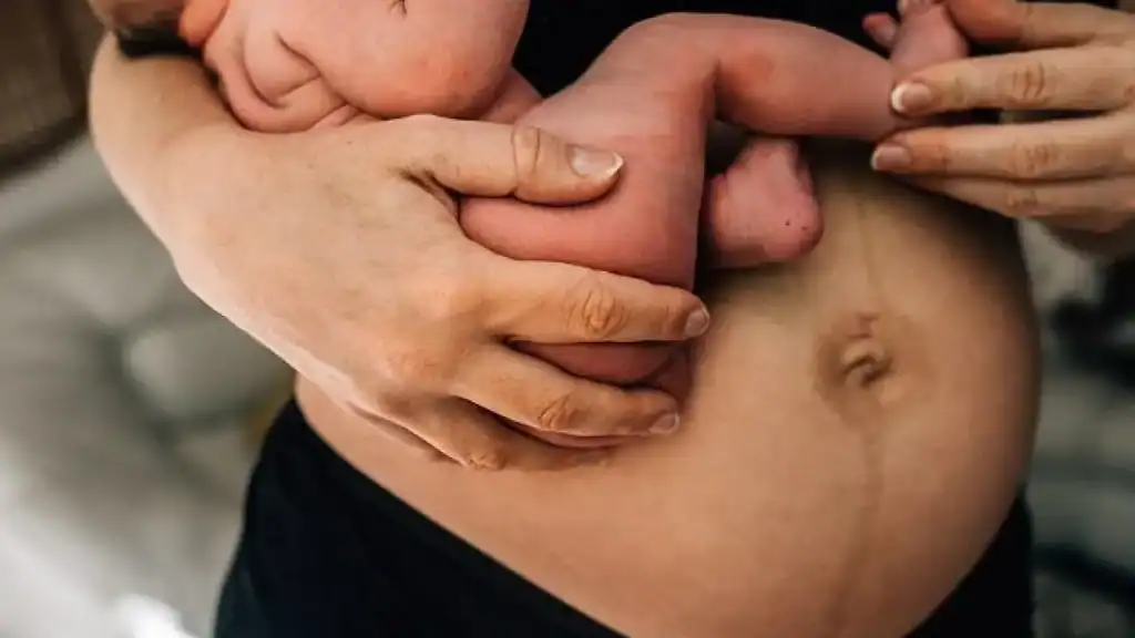 Why Is My Stomach Still Big After Pregnancy Willenhall?