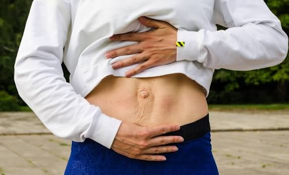 When Could Diastasis Recti Be the Missing Piece of the Puzzle Willenhall?